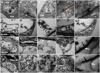 Neurexin and neuroligins jointly regulate synaptic degeneration at the Drosophila neuromuscular junction based on TEM studies